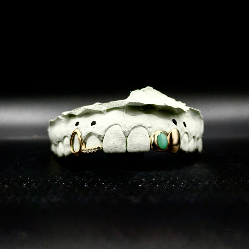 Solid Gold Grillz — Custom Fit (10K / 14K / 18K)