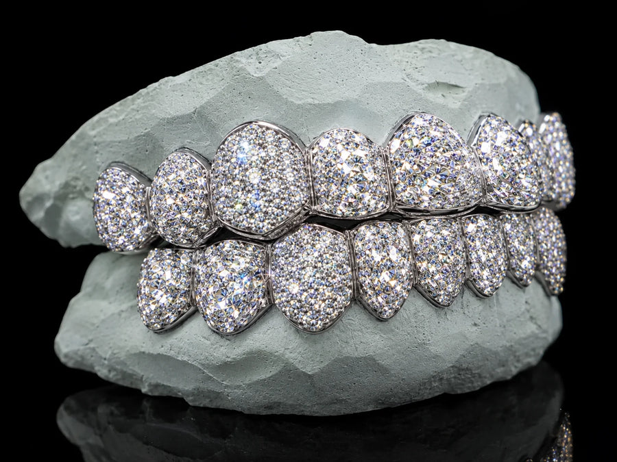 Moissanite grillz full set shown for reference